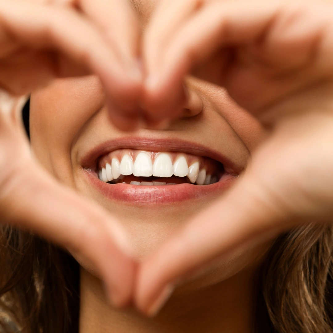 Brackets de zafiro transparentes en dientes